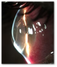 Eye with CTAK segment